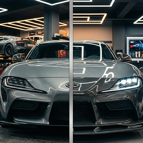 Facelift (Makyaj Kasa Dönüşümü)